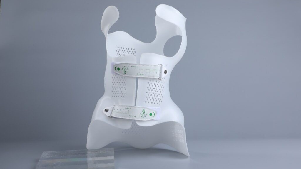3D printed scoliosis brace custom made using advanced orthotic technology